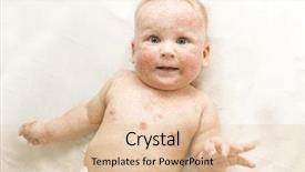  Presentation with dermatitis - Colorful theme enhanced with skin rash - little baby with dermatitis backdrop and a lemonade colored foreground