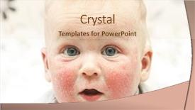  Presentation with dermatitis - Slide deck consisting of skin rash - little baby with dermatitis background and a lemonade colored foreground