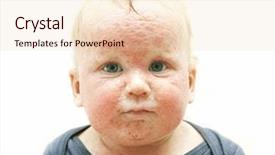  Presentation with dermatitis - Theme featuring skin rash - little baby with dermatitis background and a lemonade colored foreground