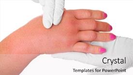  Presentation with skin doctor - Audience pleasing slides consisting of skin rash - picture of a swollen hand backdrop and a white colored foreground