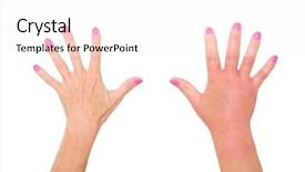  Presentation with skin - Cool new PPT theme with skin rash - picture of female hands one backdrop and a pink colored foreground