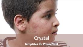  Presentation with skin - Cool new theme with skin rash - urticaria on face isolated backdrop and a coral colored foreground
