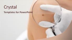  Presentation with skin cancer - Presentation enhanced with skin tumor - dermatologist examining birthmark of patient background and a lemonade colored foreground