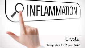  Presentation with inflammation - Audience pleasing PPT theme consisting of skin tumor - inflammation written in search bar backdrop and a white colored foreground