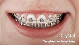  Presentation with dentistry - PPT layouts with teenage girl smiling with braces background and a coral colored foreground
