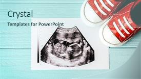  Presentation with baby ultrasound - Audience pleasing slide deck consisting of sonar - ultrasound photo and baby boots backdrop and a cool aqua colored foreground