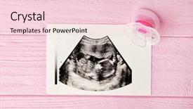 Presentation with ultrasound - Theme enhanced with sonar - ultrasound photo and pacifier background and a lemonade colored foreground