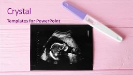  Presentation with pregnancy - Beautiful PPT layouts featuring sonar - ultrasound photo and pregnancy test backdrop and a lemonade colored foreground