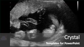  Presentation with baby ultrasound - Colorful slides enhanced with sonar - ultrasound scan of baby backdrop and a dark gray colored foreground
