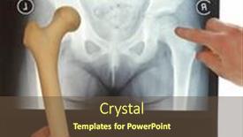  Presentation with bone - Amazing slide deck having specialist-with-femur-bone-model backdrop and a tawny brown colored foreground