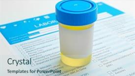  Presentation with laboratory urine - Amazing slides having specimen cup of urine test backdrop and a sky blue colored foreground