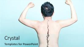  Presentation with spine - Amazing PPT theme having spinal - bare back of man backdrop and a light blue colored foreground