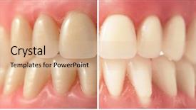  Presentation with teeth whitening - PPT layouts with stained - teeth whitening background and a lemonade colored foreground