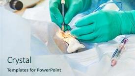  Presentation with ophthalmology surgery - Colorful slide deck enhanced with sterilization technique - eyesight correction ophthalmology laser surgery backdrop and a sky blue colored foreground