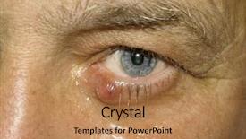  Presentation with medical eye - Amazing PPT theme having sti - man with a medical condition backdrop and a  colored foreground