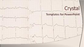 Presentation with heart rhythm - Slide deck having stress test cardiology - heart rhythm chart for background background and a sky blue colored foreground