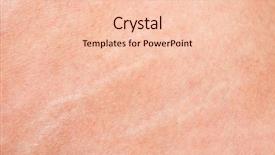  Presentation with stretch - Slides consisting of stretch-marks-closeup-on-mature background and a lemonade colored foreground