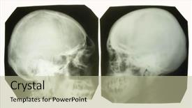  Presentation with dental x ray - Amazing presentation design having subconscious mind - x-ray picture of the two backdrop and a mint green colored foreground