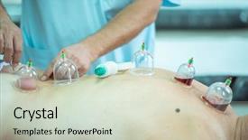  Presentation with body - Colorful PPT theme enhanced with suction - man taking cupping therapy backdrop and a soft green colored foreground