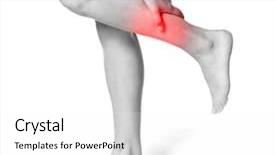  Presentation with health care consumer - Colorful slide set enhanced with suffering from pain in calf backdrop and a white colored foreground