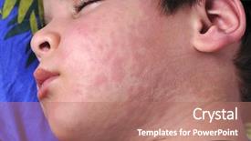  Presentation with nettle - Slides consisting of suffering severe urticaria nettle rash background and a coral colored foreground