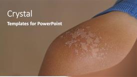  Presentation with skin - Colorful slide deck enhanced with sunburned-skin-peeling-skin backdrop and a violet colored foreground