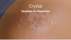  Presentation with skin - Cool new slide set with sunburned-skin-peeling-skin backdrop and a coral colored foreground