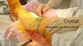  Presentation with nurse and patient holding hands - Slides featuring hands of surgeons and patient' background and a yellow colored foreground