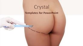  Presentation with cosmetic surgery - 