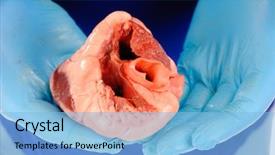  Presentation with transplant - Beautiful slide set featuring surgeon holding heart ready backdrop and a light blue colored foreground