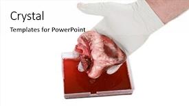  Presentation with heart surgery - Beautiful PPT theme featuring surgeon holds a human heart backdrop and a white colored foreground