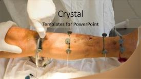  Presentation with orthopedic - Presentation theme with magnetic separation - series of happy smiling faces background and a lemonade colored foreground