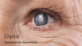  Presentation with eye cataract - PPT layouts with surgery - cataract concept senior woman's eye background and a coral colored foreground