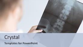  Presentation with roentgen - Amazing PPT layouts having surgery - close up of male doctor backdrop and a light blue colored foreground