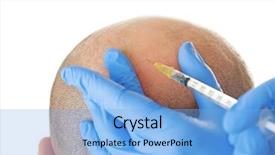  Presentation with hair loss - Beautiful slide set featuring surgery - man with hair loss problem backdrop and a light blue colored foreground