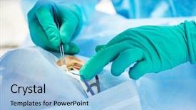  Presentation with eye surgery - Presentation theme featuring surgery - ophthalmology operation surgeon's hands background and a light blue colored foreground