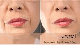  Presentation with surgery - Cool new PPT theme with surgery - senior woman backdrop and a coral colored foreground