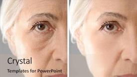  Presentation with surgery - Amazing slide deck having surgery - senior woman backdrop and a lemonade colored foreground