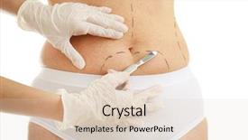  Presentation with mature female surgeon - Presentation design having surgery abdomen - surgeon hands with scalpel background and a lemonade colored foreground