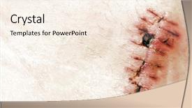  Presentation with surgical - Beautiful slide set featuring surgical incisions - detail of scar backdrop and a cream colored foreground