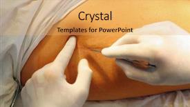  Presentation with surgical - Colorful presentation theme enhanced with surgical incisions - incision 1 backdrop and a yellow colored foreground