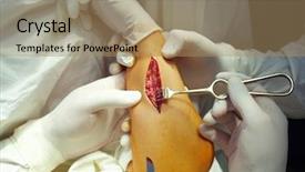  Presentation with operating room - Slide set enhanced with surgical procedure in an operating background and a  colored foreground