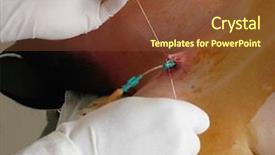  Presentation with suture - Slide deck featuring suture - surgical procedure background and a  colored foreground