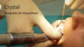  Presentation with anesthesia - Audience pleasing presentation theme consisting of suture medical - anesthesia before stomatology procedure backdrop and a  colored foreground