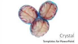  Presentation with jelly - 