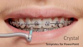  Presentation with dental hygiene - Cool new presentation theme with teen-boy-cleaning-braces-young backdrop and a coral colored foreground