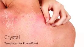  Presentation with teen - Cool new slide set with teen boy scratching his sunburned back backdrop and a lemonade colored foreground