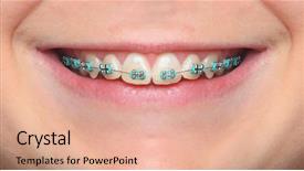  Presentation with orthodontic - Slide deck having life balance - woman practicing yoga background and a wine colored foreground