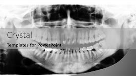  Presentation with jaw - 