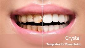  Presentation with treatment - Slide deck consisting of teeth before and after dental background and a coral colored foreground